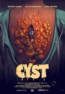 ดูหนังออนไลน์ Cyst (2020) HD